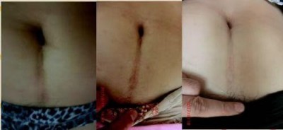 回归本源，让疤痕收回本该易防易治的本来形象！  去除疤痕——几千年做错了这一件事  排毒养疤——让疤痕还回了本容易康复的事情