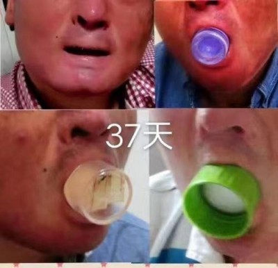 回归本源，让疤痕收回本该易防易治的本来形象！  去除疤痕——几千年做错了这一件事  排毒养疤——让疤痕还回了本容易康复的事情