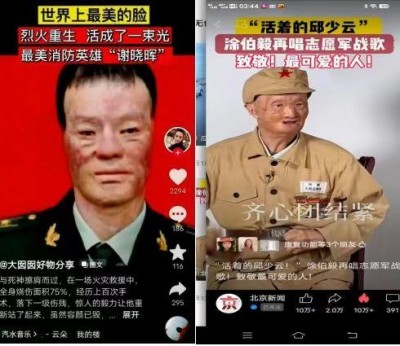 回归本源，让疤痕收回本该易防易治的本来形象！  去除疤痕——几千年做错了这一件事  排毒养疤——让疤痕还回了本容易康复的事情