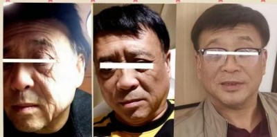 回归本源，让疤痕收回本该易防易治的本来形象！  去除疤痕——几千年做错了这一件事  排毒养疤——让疤痕还回了本容易康复的事情