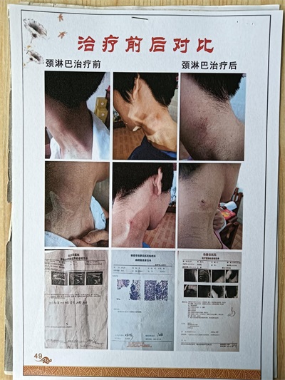 杨宗仙：  中医传承创新领路人，  为民治病写下传奇故事