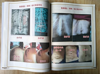 杨宗仙：  中医传承创新领路人，  为民治病写下传奇故事