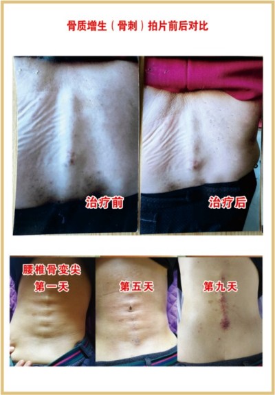 杨宗仙：中医传承创新领路人，为民治病写下传奇故事