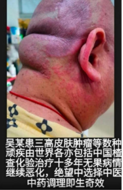 现代医疗手段与古代中医文化》 一一 疗效才是硬道理一一