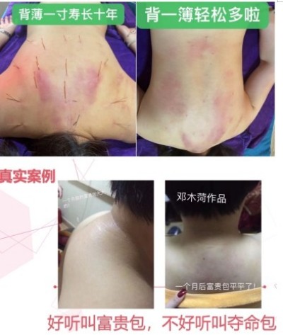 恭贺著名中医针灸非遗传承人邓国珍被央视在线直播网特聘为客座教授