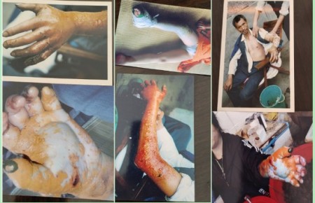 聚焦两会特别报道：蛇伤救治“守护者”汪炳炎——用医者仁心诠释基层担当